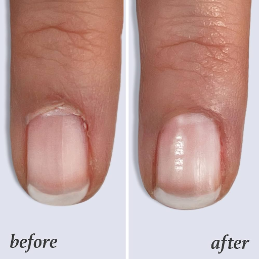 How long does it take to see results from using cuticle oil