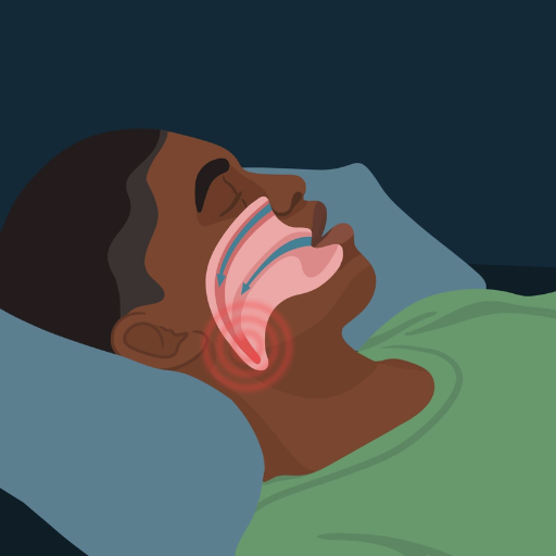 What Causes You to Snore